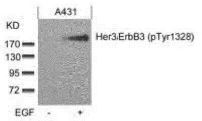 Western Blot: ErbB3/Her3 [p Tyr1328] Antibody [NBP1-04970]